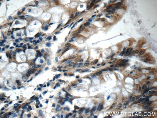 [25694-1-AP-150UL] OSGEPL1 Polyclonal antibody