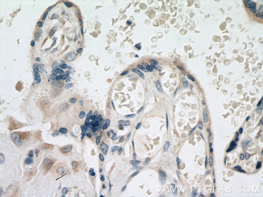 [25703-1-AP-20UL] GDPD5 Polyclonal antibody