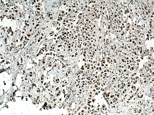 [25707-1-AP-150UL] RPUSD2 Polyclonal antibody