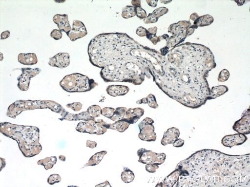 [25708-1-AP-150UL] CXorf61 Polyclonal antibody