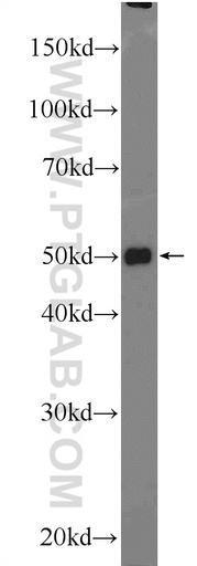 [25713-1-AP-150UL] TTC7B Polyclonal antibody