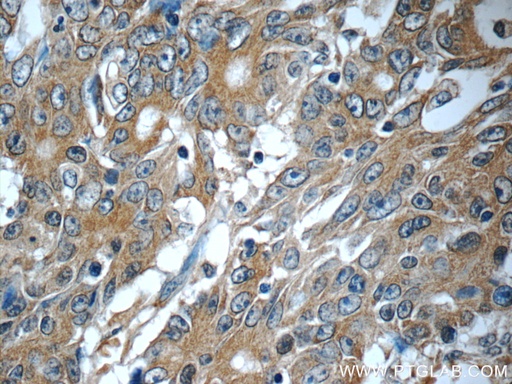 [25721-1-AP-20UL] KIAA0841 Polyclonal antibody