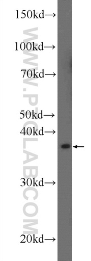 [25723-1-AP-150UL] AGPAT3 Polyclonal antibody