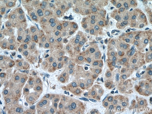 [25725-1-AP-150UL] CARNS1 Polyclonal antibody