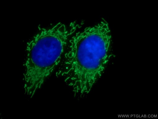 [25729-1-AP-20UL] SERAC1 Polyclonal antibody