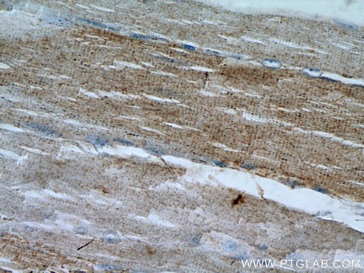 [25732-1-AP-150UL] LPPR2 Polyclonal antibody