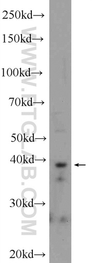 [25739-1-AP-20UL] IMPAD1 Polyclonal antibody
