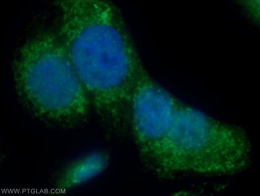 [25740-1-AP-20UL] IQCK Polyclonal antibody