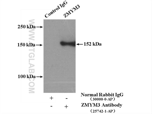 [25742-1-AP-20UL] ZMYM3 Polyclonal antibody