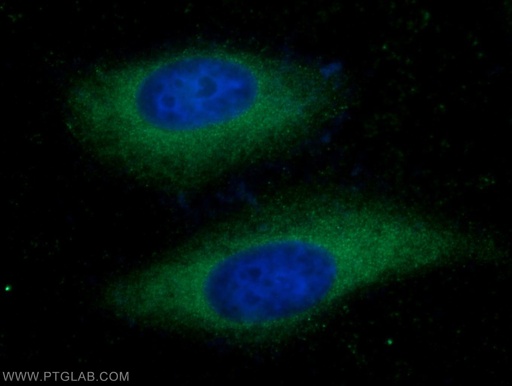 [25752-1-AP-150UL] COX20 Polyclonal antibody