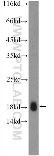 [25753-1-AP-20UL] TR2IT1 Polyclonal antibody