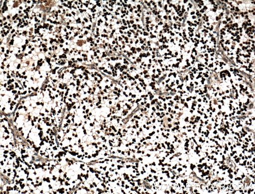 [25754-1-AP-20UL] OLIG2 Polyclonal antibody
