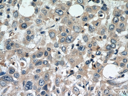 [25761-1-AP-20UL] DEFB121 Polyclonal antibody