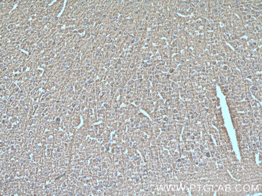 [25763-1-AP-150UL] SNX32 Polyclonal antibody