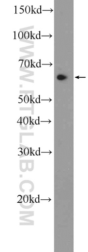 [25764-1-AP-20UL] CCDC102A Polyclonal antibody