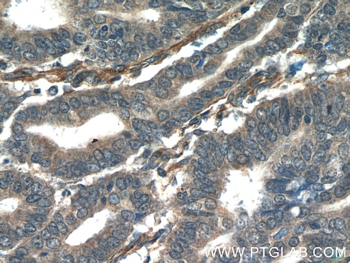 [25766-1-AP-20UL] ORAI3 Polyclonal antibody