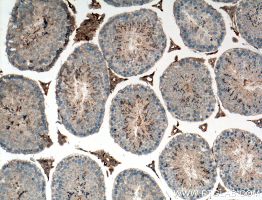 [25767-1-AP-20UL] C1orf113 Polyclonal antibody
