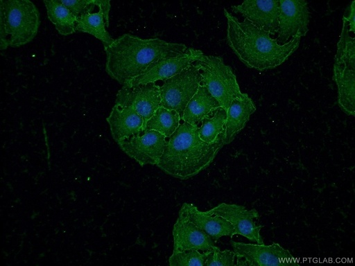 [25770-1-AP-20UL] Drebrin Polyclonal antibody