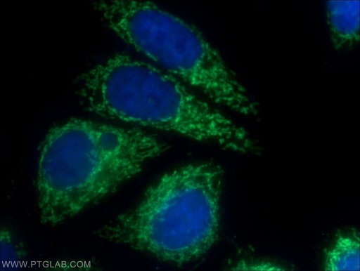 [25781-1-AP-150UL] UQCC2 Polyclonal antibody