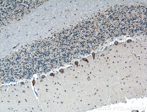 [25783-1-AP-20UL] LRP2BP Polyclonal antibody