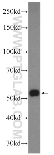 [25785-1-AP-150UL] ZNF394 Polyclonal antibody