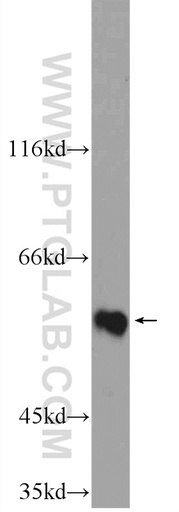 [25797-1-AP-20UL] ZNF649 Polyclonal antibody