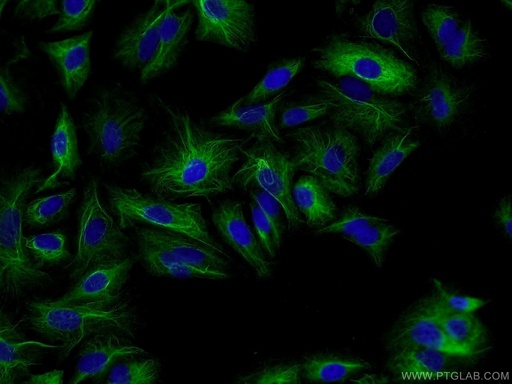 [25803-1-AP-20UL] RMND5B Polyclonal antibody