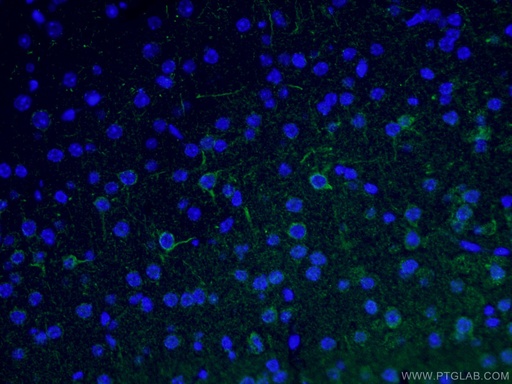 [25805-1-AP-150UL] NF-M Polyclonal antibody