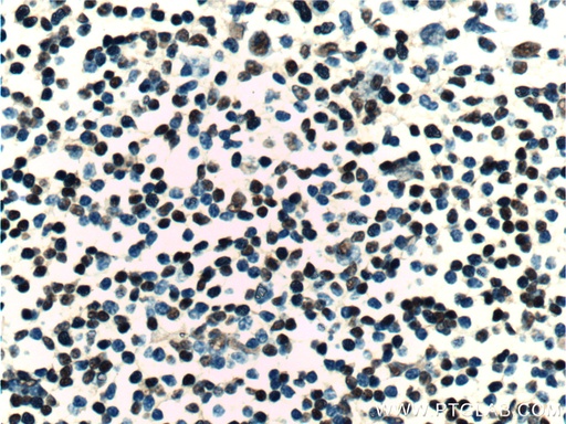 [25807-1-AP-150UL] ZC3H18 Polyclonal antibody