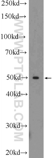 [25813-1-AP-150UL] TOM1 Polyclonal antibody
