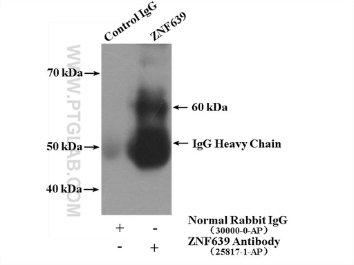 [25817-1-AP-20UL] ZNF639 Polyclonal antibody