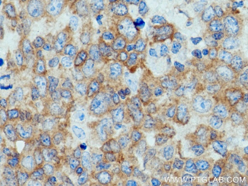 [25818-1-AP-150UL] c-Cbl Polyclonal antibody