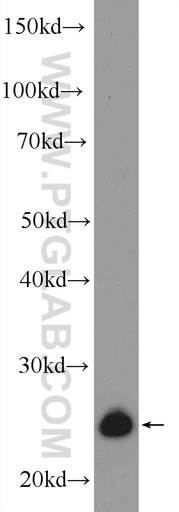 [25819-1-AP-20UL] ZMAT2 Polyclonal antibody