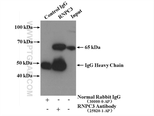 [25820-1-AP-20UL] RNPC3 Polyclonal antibody