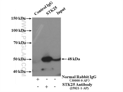 [25821-1-AP-20UL] STK25 Polyclonal antibody