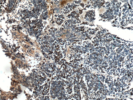 [25825-1-AP-20UL] VSX2 Polyclonal antibody