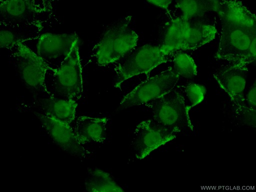 [25829-1-AP-20UL] TFAP2E Polyclonal antibody