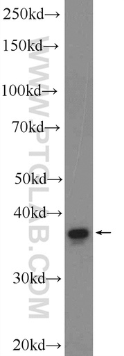 [25833-1-AP-20UL] DEPP Polyclonal antibody