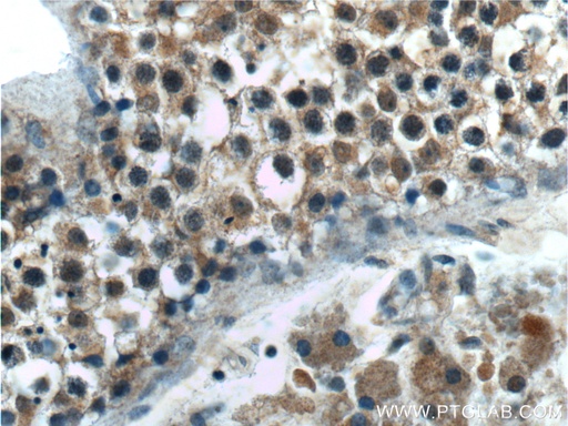 [25834-1-AP-150UL] TPRX1 Polyclonal antibody