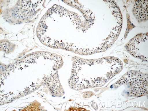 [25836-1-AP-20UL] RGSL1 Polyclonal antibody