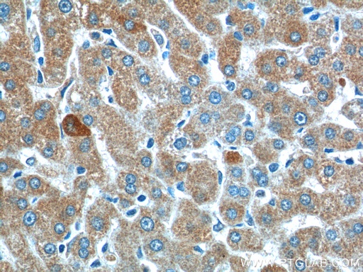 [25840-1-AP-20UL] SMAD7 Polyclonal antibody