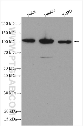 [25842-1-AP-20UL] ROR2 Polyclonal antibody