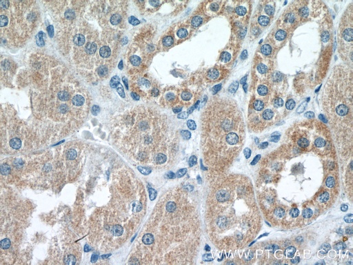 [25843-1-AP-20UL] RAB11FIP3 Polyclonal antibody