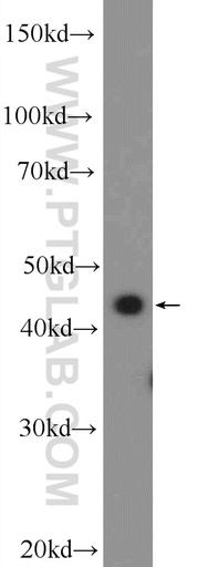 [25845-1-AP-20UL] SUDS3 Polyclonal antibody