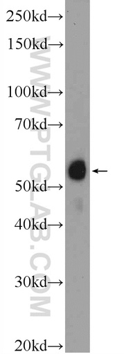 [25849-1-AP-150UL] ACD Polyclonal antibody