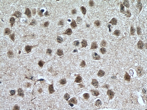 [25851-1-AP-20UL] NR4A1 Polyclonal antibody