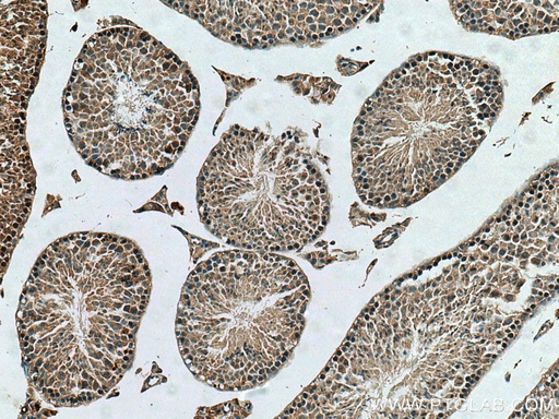 [25856-1-AP-150UL] TUBGCP2 Polyclonal antibody