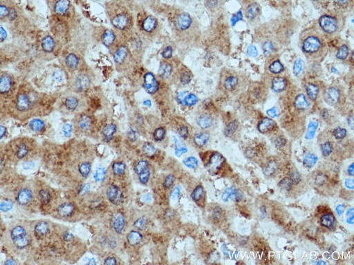 [25857-1-AP-150UL] SAC3D1 Polyclonal antibody