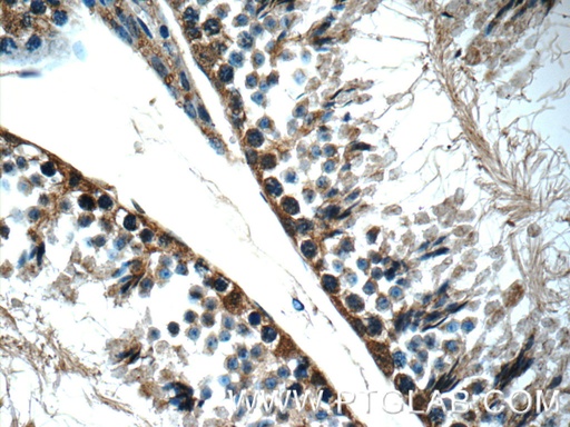 [25858-1-AP-150UL] TEX264 Polyclonal antibody