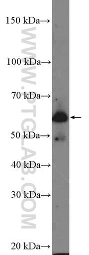 [25861-1-AP-20UL] SPATC1 Polyclonal antibody